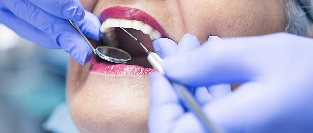 Best Cracked Tooth Emergency Dentist  in Broadview, IL